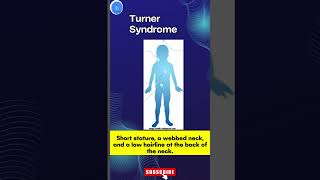 Turner Syndrome A Genetic Disorder Turner Syndrome Awareness [upl. by Oza]