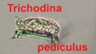 trichodina pediculus [upl. by Nainatrad]