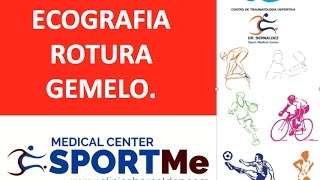 Ecografia de una Rotura fibrilar gemelo medial La importancia de la Ecografia en Traumatologia [upl. by Atinus]