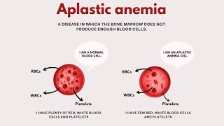 Aplastic Anaemia  Characteristics Causes Symptoms Diagnosis and Treatment [upl. by Guild]