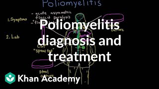 Poliomyelitis diagnosis and treatment  Infectious diseases  NCLEXRN  Khan Academy [upl. by Edla]