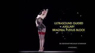 lecture  presentation  ultrasound guided axillary brachial plexus block [upl. by Ojeillib474]