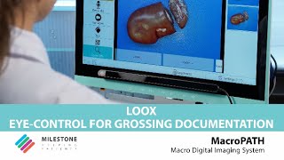 LOOX EyeControl for Grossing Documentation [upl. by Philipps]