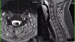 neuroradiology masterclass P2 [upl. by Ecirtal646]