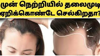 மேல் நெற்றியில் 100 முடி வளர Hair Growth Tips for Forehead in TamilStop Hair Fall Tamil [upl. by Grof]