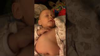 Example of Retractions Belly Breathing and Tachypnea in Infant [upl. by Hayley]