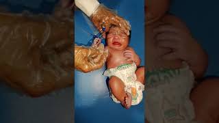 Suction process dr remove bad wayer from stomach and cleaned it carefully newborn baby [upl. by Nnayd]