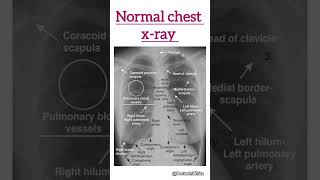 Normal chest xray  shortsvideo xray normalxray [upl. by Canning]