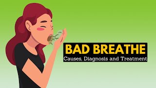 Bad Breath halitosis Causes Sign and Symptoms Diagnosis and Treatment [upl. by Noraf962]