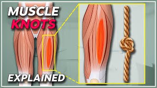 What is a muscle knot  Muscle knots amp trigger points explained [upl. by Atem654]