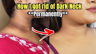 How to get rid of DARK NECK PERMANENTLY [upl. by Victoir]