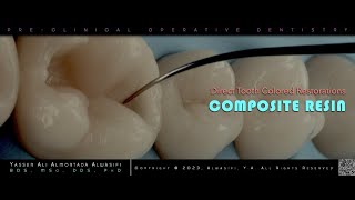 Composite Resin Restoration  I [upl. by Uno]