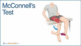 McConnells Test  A Chiropractic Online CE™ Production [upl. by Rhetta]