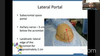 Basics of Shoulder Arthroscopy  Dr B Bhupesh Karthikeyan [upl. by Suzzy]