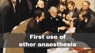 16th October 1846 First public demonstration of ether anaesthesia [upl. by Eenhat407]