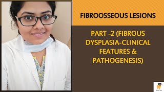 Fibrous Dysplasia Part 1  Fibroosseous Lesions Lecture Series  BDS MDS Online Video Lecture [upl. by Notled]