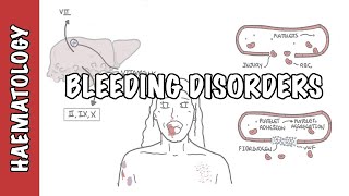 Approach to bleeding disorders  causes pathophysiology and investigations [upl. by Lletnahs]