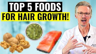 THESE ARE THE TOP 5 FOODS FOR HAIR GROWTH [upl. by Elisa984]