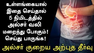 அல்சர் குணமாக வீட்டு வைத்தியம்  Ulcer Treatment in Tamil Ulcer Symptoms in Tamil Tamil Health Tips [upl. by Urania]