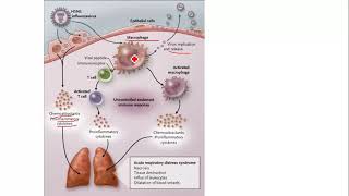 Patogenesis Influenza  FLU BURUNG H5N1  Respirasi  Paru  Patofisiologi  Pneumonia [upl. by Rudich610]