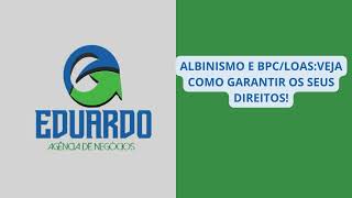 ALBINISMO E BPCLOASVEJA COMO GARANTIR SEUS DIREITOSEduardo Agência de NegóciosMeleiroSC [upl. by Ensign]