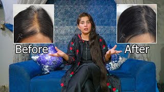 My Hair Care Routine For Hair Growth  Tips And Tricks For Healthy Hair  Stop Hair Fall  Aneeza [upl. by Aneerahs]