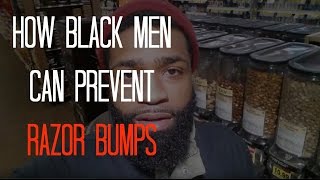 How Black Men Can Prevent Razor Bumps [upl. by Simons713]