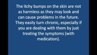 Itchy bumps on skin  what are they and how to get rid of them [upl. by Terrene797]