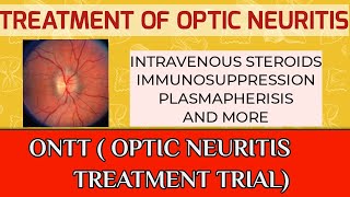 Treatment of optic neuritis and multiple sclerosis [upl. by Nnire]