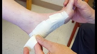 LowDye Strapping for Plantar Fasciitis [upl. by Notna434]