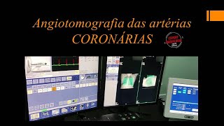 ANGIOTOMOGRAFIA DAS ARTÉRIAS CORONÁRIAS  REALIZAÇÃO DO EXAME [upl. by Danby]