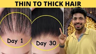 How to Treat Thinning Hair The Holistic Way [upl. by Etteyniv]