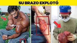 Estos Musculos Falsos Salieron Terriblemente Mal [upl. by Enyehc]