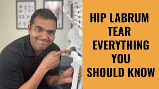 Hip Labrum Tears  Everything You Absolutely Need To Know [upl. by Kall327]