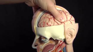 Increased ICP Intracranial Pressure Nursing Care Animation [upl. by Ewell825]