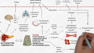 Fisiopatología de la pancreatitis aguda en 6 minutos [upl. by Kuska]