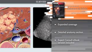 Diagnostic Ultrasound Abdomen and Pelvis [upl. by Lari478]