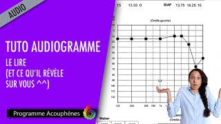 Acouphènes  Tuto audiogramme  le lire et ce quil révèle sur vous [upl. by Akiemaj]