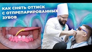 ОРТОПЕДИЧЕСКАЯ СТОМАТОЛОГИЯ КАК СНЯТЬ ОТТИСК [upl. by Nonnah]