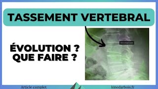 Tassement vertebral  conduite à tenir exercices opération [upl. by Sabir]