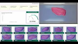 Chicken Membrane Detection [upl. by Ariella100]