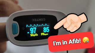 How my pulse oximeter tells me when I have Atrial fibrillation  aFib  AF  not a EKG or ECG [upl. by Alyt]