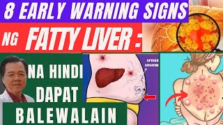 8 Early Warning Signs ng Fatty Liver Na Hindi Dapat Balewalain  By Doc Willie Ong [upl. by Rehpetsirhc565]