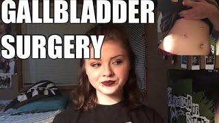 Story TimeMy Gallbladder Surgery [upl. by Marion]