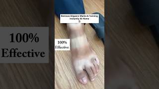 Remove Slipper Marks or Suntan  Get fair feet in 10 Min Most Easy Pedicure at home shorts [upl. by Ahteral]