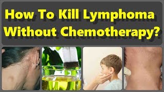 How To Kill Lymphoma Without Chemotherapy But With The Natural Remedies [upl. by Ykceb]