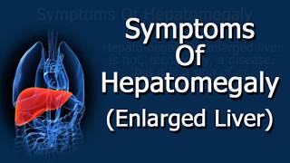 Symptoms Of Hepatomegaly Enlarged Liver [upl. by Atalanti]