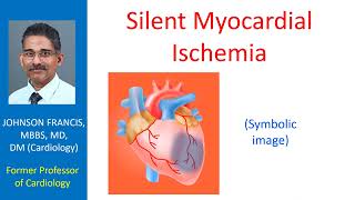 Silent myocardial ischemia [upl. by Isabea]