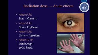 Radiation Hazards and Protection [upl. by Fanchan]