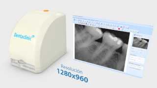 Digitalizador de Radiografías USB  Dentaclinic [upl. by Ydaj]